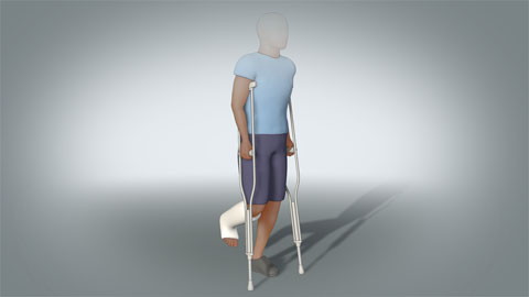 Using Crutches: Discharge Instructions